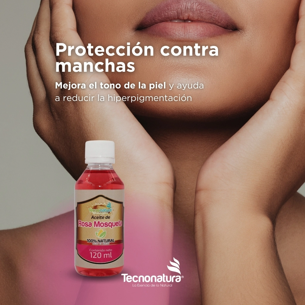 aceite mosqueta